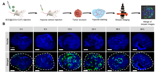 中國科學(xué)技術(shù)大學(xué)王育才教授:納米級聯(lián)簇化酶用于腫瘤葡萄糖耗竭治療